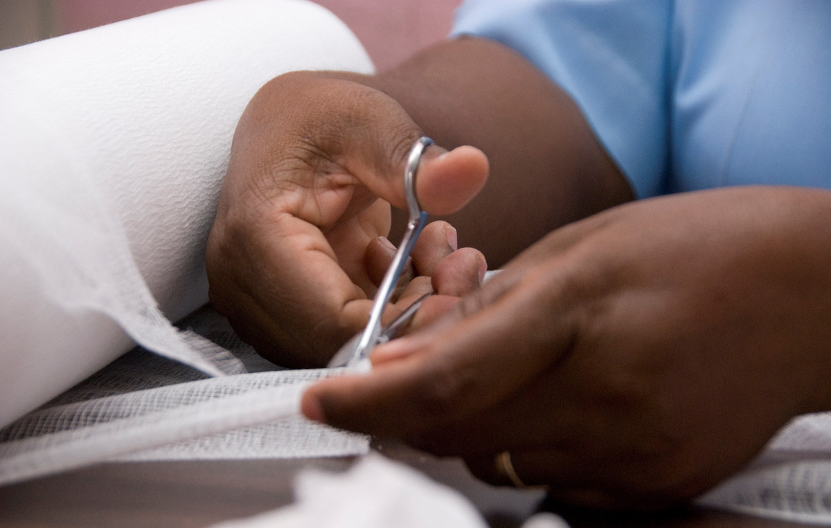 Eine Krankenschwester schneidet Verband. Foto (Symbolbild): Adveniat/Deselaers